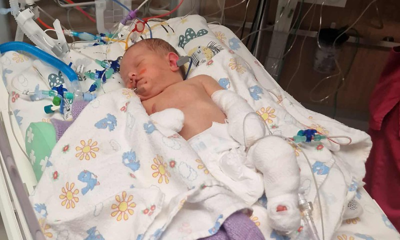 Üliharuldase geenihaigusega Emma on haiglas kriitilises seisus. Teda saab aidata ravim, mis maksab 53 816 eurot kuus