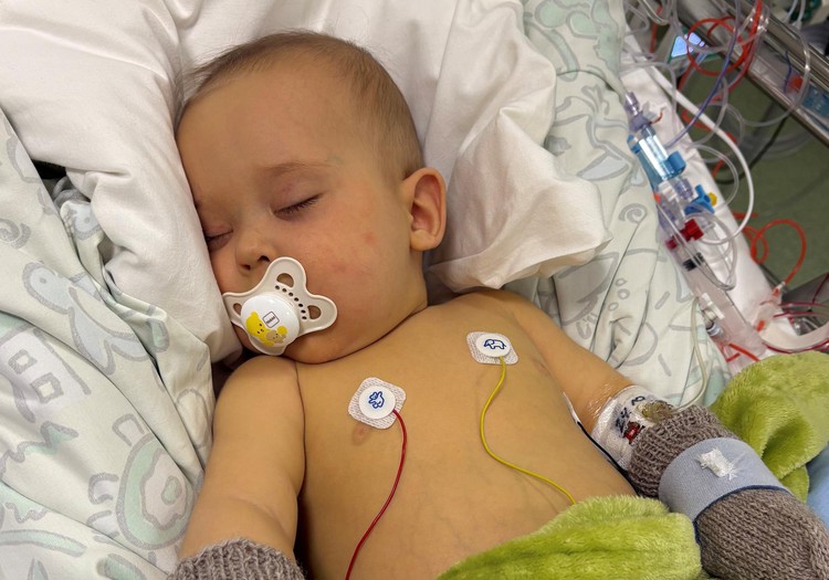 Haruldase maksahaigusega 6-kuune Aaron viidi sisemise verejooksu tõttu Helsingi lastehaiglasse