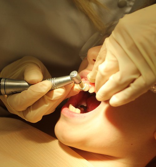 Kooli minev laps peaks külastama ortodonti