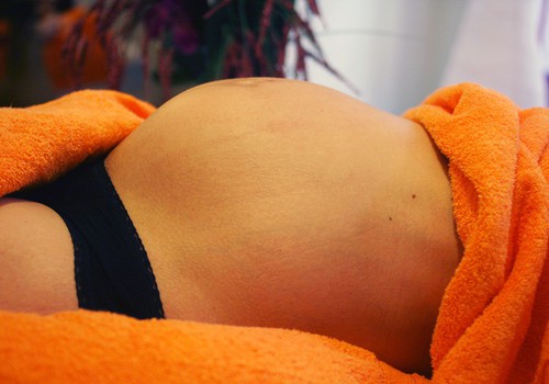 Emmede Klubi lugeja küsib: Kas seliliasendist põhjustatud valutorked on raseduse alguses normaalsed?