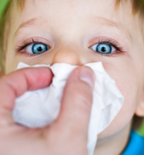 Miks on tänapäeval lastel nii palju allergiaid?