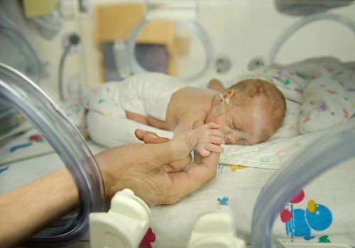 Ligi kolmandik Eesti lapsi sünnib haigena