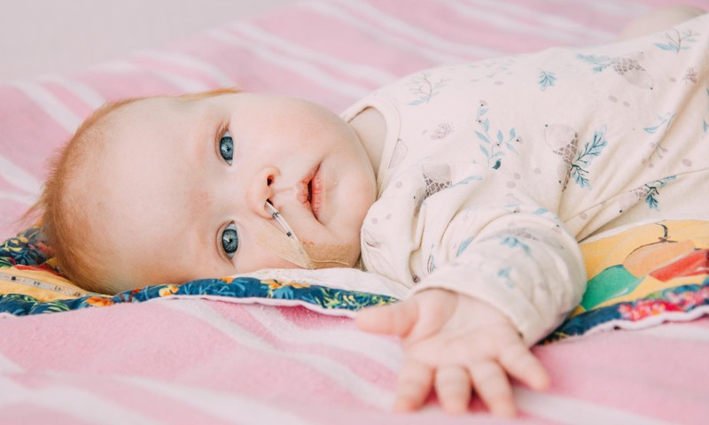 Pooleaastast Anni ootab Soomes keeruline söögitoru operatsioon – palun aita emal-isal olla sel raskel ajal oma pisitütre juures!