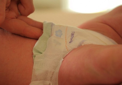 Väikeste beebide suur probleem - mähkmedermatiit