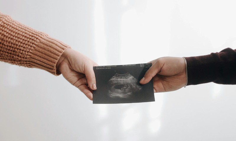 Abordi keelustamise mõju? Väärarenguga laste sünnid ja surmad