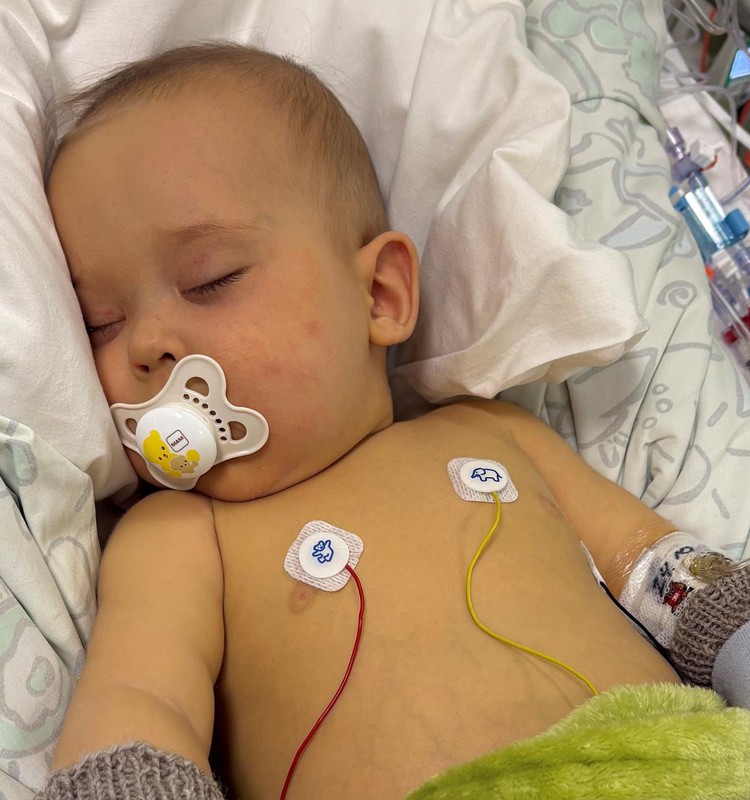 Haruldase maksahaigusega 6-kuune Aaron viidi sisemise verejooksu tõttu Helsingi lastehaiglasse