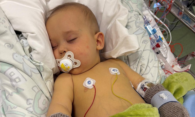 Haruldase maksahaigusega 6-kuune Aaron viidi sisemise verejooksu tõttu Helsingi lastehaiglasse